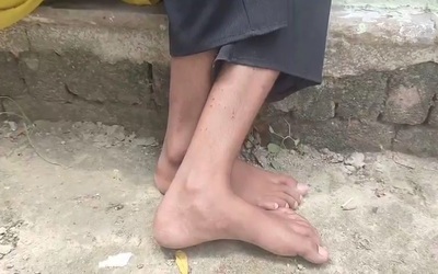 Bé gái bị rắn cắn 9 lần trong vòng 40 ngày