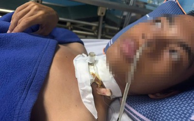 Cứu sống nam thanh niên bị đứt khí quản do vướng phải dây điện