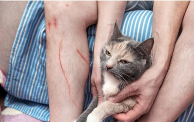 Bị mèo cào, người đàn ông 71 tuổi tử vong trong đau đớn