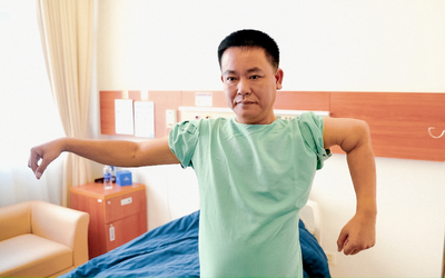 Gần 3 thập kỷ sống chung với khuỷu tay biến dạng, người đàn ông hồi phục vận động ngoạn mục nhờ công nghệ in 3D