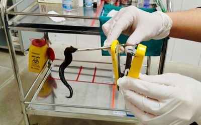 Đi khám, người đàn ông sốc nặng khi thấy thứ đáng sợ trong mũi mình