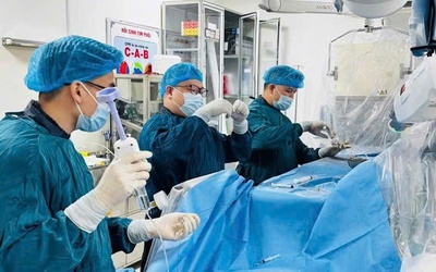 Người trẻ bị đột quỵ ngày càng nhiều và cảnh báo của bác sĩ