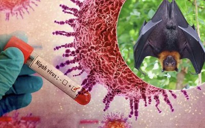 Sở Tp.HCM thông tin về tình hình, phương án phòng chống bệnh do virus Nipah
