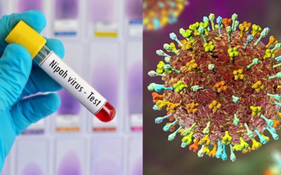 Bộ Y tế hoả tốc yêu cầu cơ sở khám chữa bệnh chủ động phòng chống bệnh do virus Nipah
