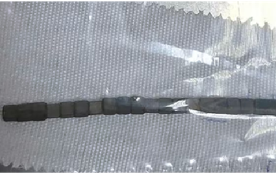 Bé trai hơn 2 tuổi "bụng cứng như đá", bác sĩ phát hiện bí mật "đáng sợ"