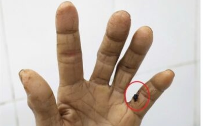 Người phụ nữ 60 tuổi "cứng hàm" suýt mất mạng vì bị gà đá