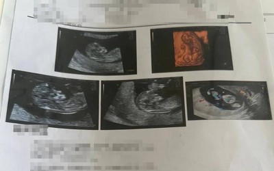 Đi khám thai, người phụ nữ sốc nặng sau khi thấy kết quả siêu âm