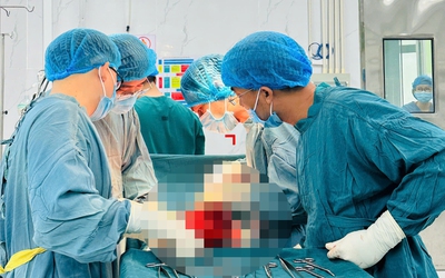 Chủ quan không điều trị, người phụ nữ mang khối u tử cung “khổng lồ” nhiều năm