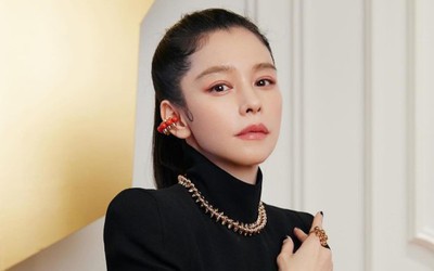 Nữ nghệ sĩ nổi tiếng hé lộ những vết sẹo che giấu suốt 2 thập kỷ