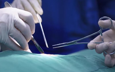Cụ bà 74 tuổi vào viện phẫu thuật chân phải, bác sĩ cắt nhầm chân trái