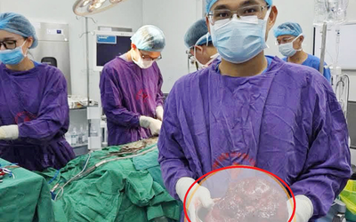 Bụng to bất thường, người đàn ông sốc khi bác sĩ gắp ra thứ "đáng sợ" nặng 2kg bên trong