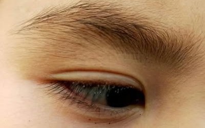 Bé trai 4 tuổi ngứa mắt, mẹ sốc khi bác sĩ gắp ra thứ "đáng sợ" bên trong