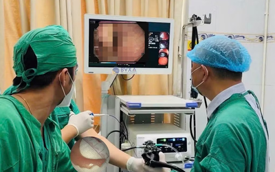 Đang uống nước, người đàn ông 51 tuổi bất ngờ nuốt nhầm thứ khó tin
