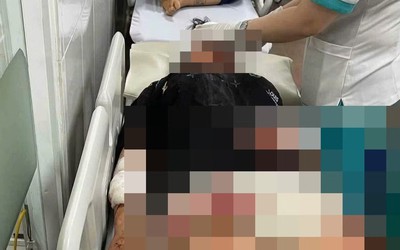 Nữ sinh lớp 11 dùng dao tấn công khiến học sinh lớp 9 nhập viện