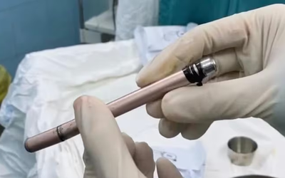 Thiếu nữ 16 tuổi nhập viện trong đêm sau tai nạn ngoài ý muốn