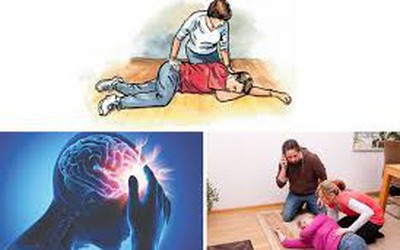 Đột quỵ não gia tăng và những dấu hiệu cảnh báo