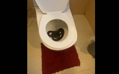 Người phụ nữ sốc nặng khi thấy cảnh tượng trong bồn cầu