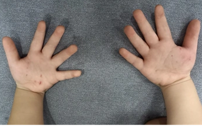 Con đang chơi bỗng khóc ngặt nghẽo, mẹ sững sờ khi phát hiện “bí mật”