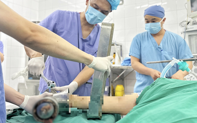 Một phút bất cẩn bên máy xay thịt, người phụ nữ trẻ phải trả giá đắt