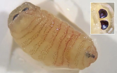 Người phụ nữ 58 tuổi “sốc nặng” khi hắt hơi ra hàng loạt con giòi sống từ trong mũi