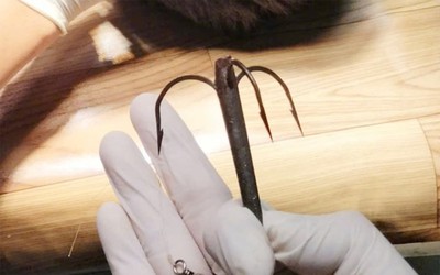 Thiếu niên gặp sự cố hi hữu khi đi câu cá, phải nhập viện xử lý gấp