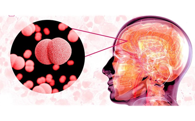 Bệnh nguy hiểm đã có 4 ca không qua khỏi, Viện Pasteur Tp.HCM cảnh báo