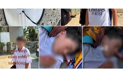 Nam sinh lớp 6 bị đánh hội đồng chỉ vì không cho mượn xe đạp