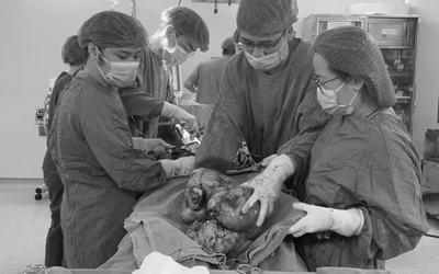 Đau âm ỉ vùng bụng suốt, người phụ nữ sốc khi bác sĩ lấy ra thứ "đáng sợ" trong cơ thể mình