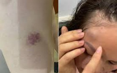 Hà Nội: Công an vào cuộc vụ một gia đình tố bị hàng xóm liên tục đe dọa, hành hung