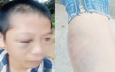 Xôn xao clip học sinh lớp 6 nghi bị người thân bạo hành