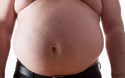 Người đàn ông bụng phình to như "mang thai", bác sĩ lấy ra thứ "đáng sợ" nặng 20kg