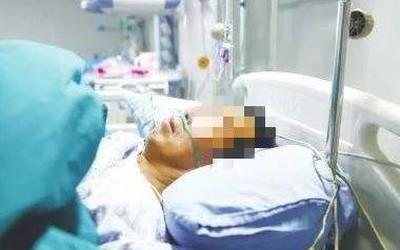 Người đàn ông 53 tuổi đột ngột bị liệt vào buổi sáng, bác sĩ chỉ rõ "sai lầm chí mạng"