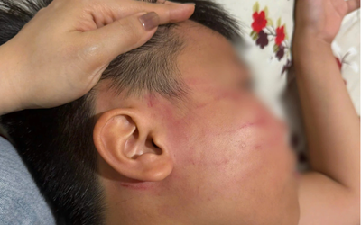 Vụ nam sinh lớp 4 bị giáo viên đánh bầm mặt: Bất ngờ phát hiện lớp dạy thêm tiếng Anh “chui”