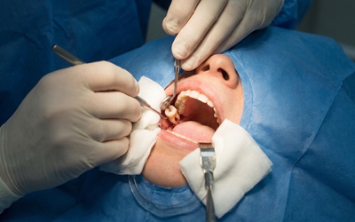 Bác sĩ nhổ nhầm răng, người phụ nữ gây náo loạn bệnh viện