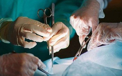 Người phụ nữ 39 tuổi phải cắt cụt chân sau khi cho chó ăn