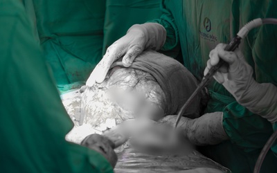 Người phụ nữ ở Hà Nội suy kiệt vì mang khối u khổng lồ 5kg