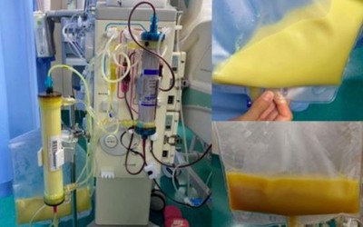 Nam thanh niên 25 tuổi "máu chuyển trắng như sữa" vì thường xuyên ăn món "vạn người mê"