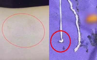 Người phụ nữ đau tay đi khám, bác sĩ kinh ngạc khi thấy thứ bên trong
