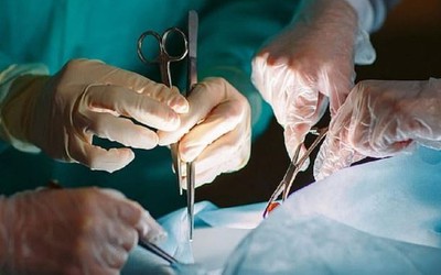 Nhập viện vì đau bụng, người đàn ông 67 tuổi sốc nặng khi bác sĩ gắp ra thứ "đáng sợ" đen sì