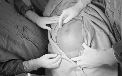 Bụng to nhanh bất thường, người phụ nữ "sốc" khi biết bí mật trong cơ thể
