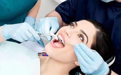 Đi nhổ răng có được bảo hiểm y tế chi trả?