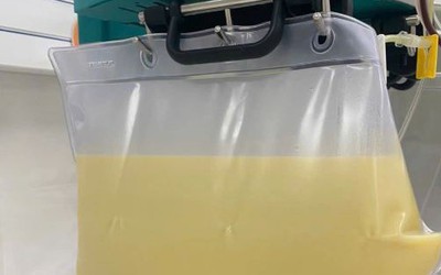 Nam thanh niên 29 tuổi "máu chuyển trắng như sữa" vì uống thứ nước quen thuộc suốt 6 tháng