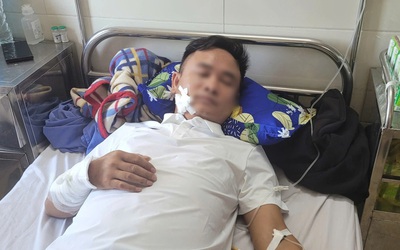 Điều tra vụ người đàn ông bị nhóm người đi ô tô nổ súng bắn trọng thương
