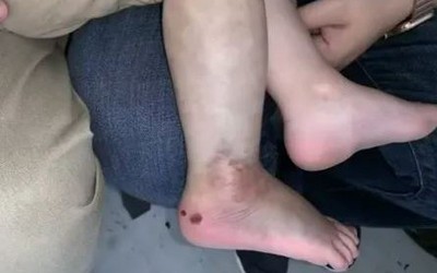 Nghe cháu trai 3 tuổi khóc thét, ông nội chạy ra thì chứng kiến cảnh "đáng sợ"