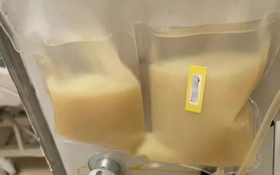 Nam thanh niên 30 tuổi "máu trắng đục như sữa" vì ăn món "khoái khẩu" trẻ em ưa thích