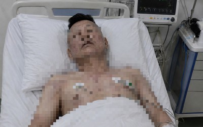 Người đàn ông 46 tuổi tử vong trên giường, bác sĩ cảnh báo loại đồ uống quen thuộc "vạn người mê"