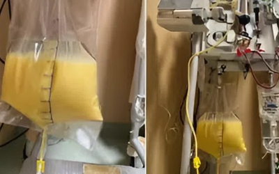 Người phụ nữ 32 tuổi "máu trắng đục như sữa" vì thứ quen thuộc trong tủ thuốc