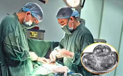 Bụng phình to bất thường, sự thật bác sĩ nói ra khiến người phụ nữ sốc nặng