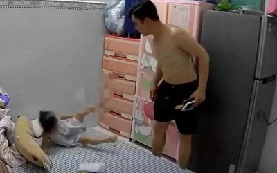 Công an vào cuộc điều tra vụ cha hờ nhiều lần bạo hành bé gái 3 tuổi