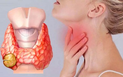Có những biểu hiện này, đừng chủ quan vì có thể là dấu hiệu ung thư